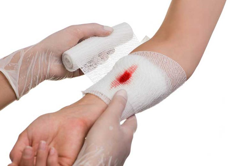 Mơ thấy bị thương điềm báo gì, số mấy?